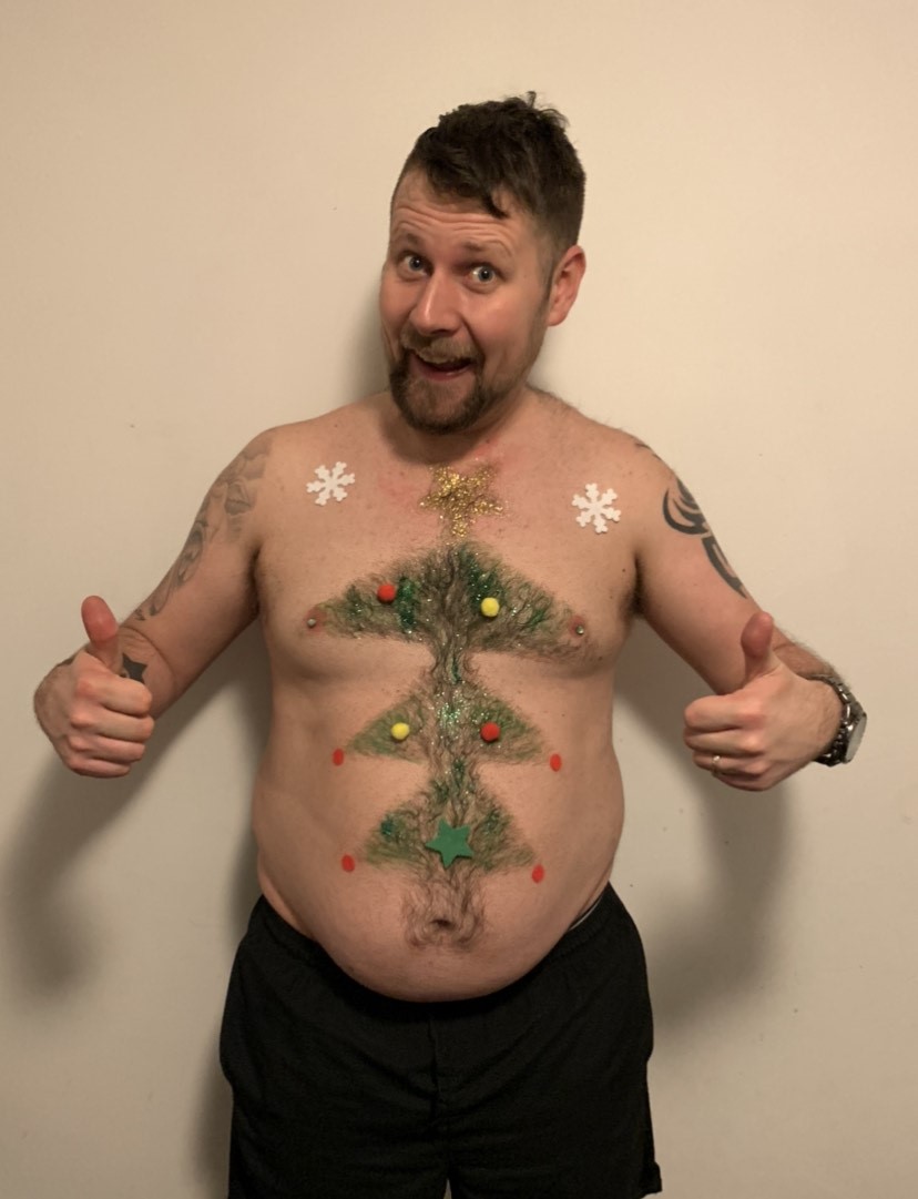 droitwich-man-shaves-christmas-tree-into-his-chest-to-raise-funds-for